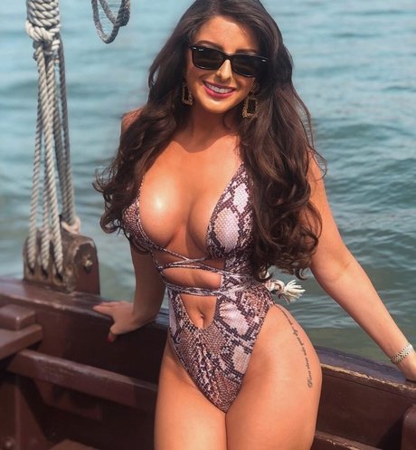 Misskayleighrosedematos