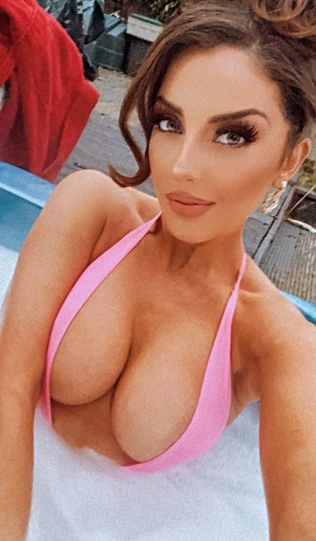 Misskayleighrosedematos