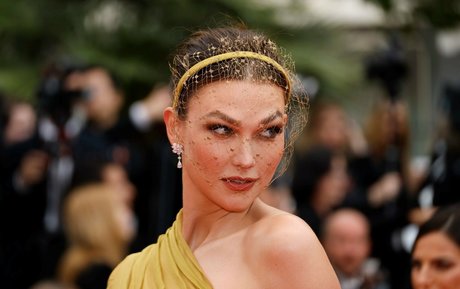Karlie Kloss