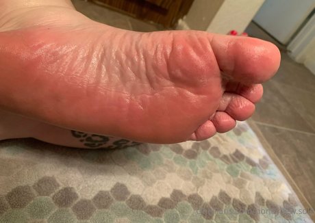 Honeydewsole
