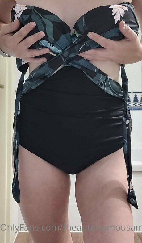 Theautonomousamputee2