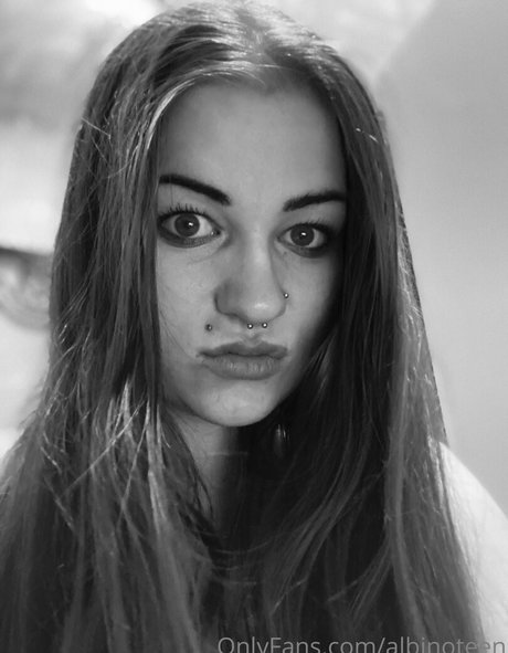 Nacktes geleaktes OnlyFans-Foto von Albinoteen