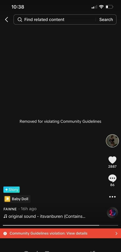 Nacktes geleaktes OnlyFans-Foto von Fawnx