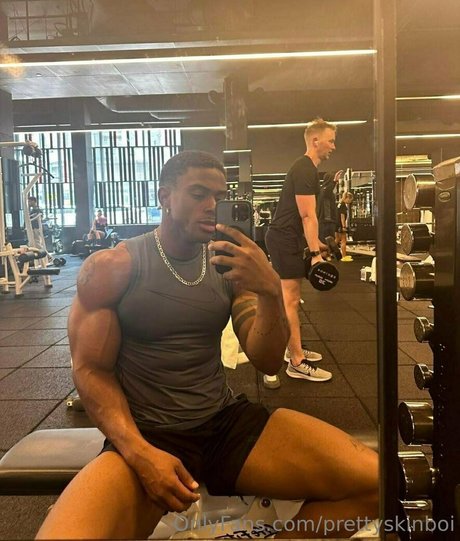 Prettyskinboi