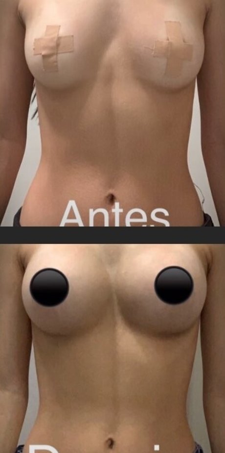Nacktes geleaktes OnlyFans-Foto von Cindy Carvalho