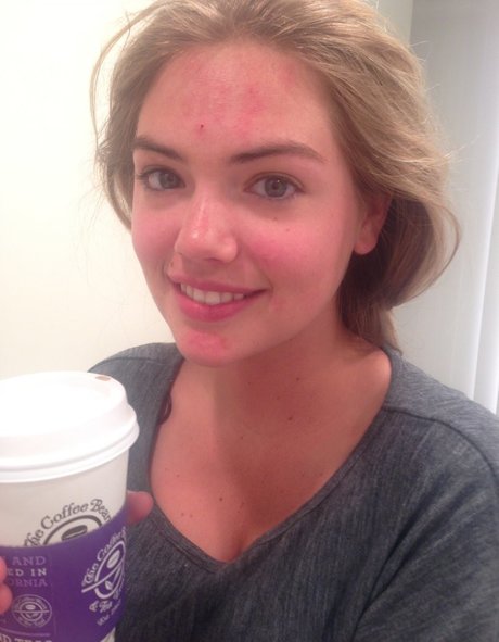 Kate Upton